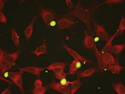 Mycoplasma pneumoniae monoclonal antibodies