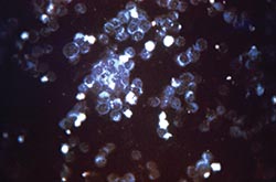 Funding for infectious disease research