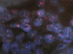 Transfer of services in genomics