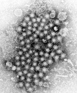 Confirming hepatitis C infection and quantifying viral load
