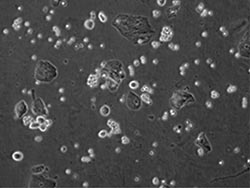 Innovative urine analysis: celebrating a milestone