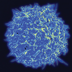 Cancer immunotherapy using patients’ T cells