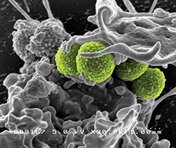 A new tool in the clinical management of sepsis