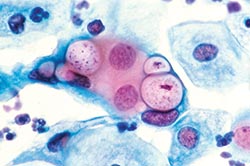 Cervical Screening Programme: 2014–15 statistics