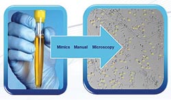 Milestone for innovative urine analysis