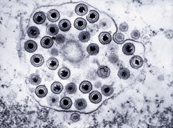 Preservation of viral DNA after storage: comparison of two transport systems