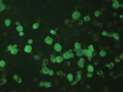 Trichomonas monoclonal antibodies