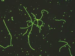 Legionella pneumophila monoclonal antibodies