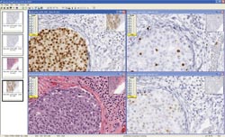 Approval for HER2 image analysis system