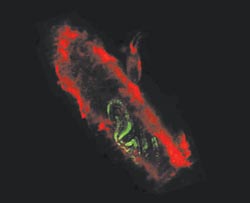 Live-cell confocal imaging