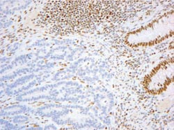 Mismatch repair antibody panel