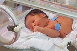 Down’s syndrome: meeting demands for first-trimester pregnancy screening