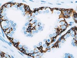 High molecular weight cytokeratins