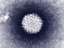 Molecular testing for human papillomavirus