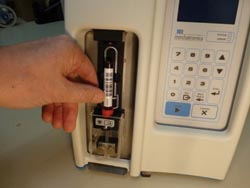 Erythrocyte sedimentation rate: old test, new machine