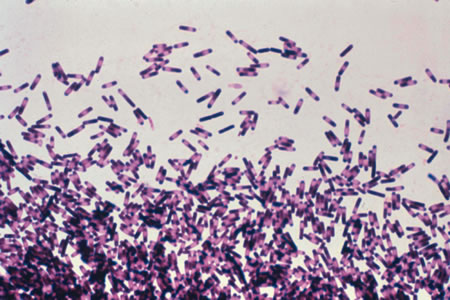 Highlighting healthcare-associated infection