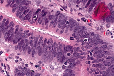 Automated faecal immunochemical testing 