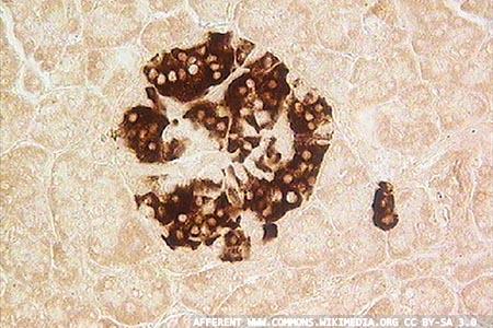 New potential in islet transplant therapy