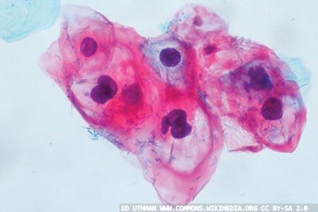 Primary screening for human papillomavirus