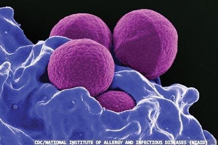Less-concentrated hydrogen peroxide fails to kill MRSA