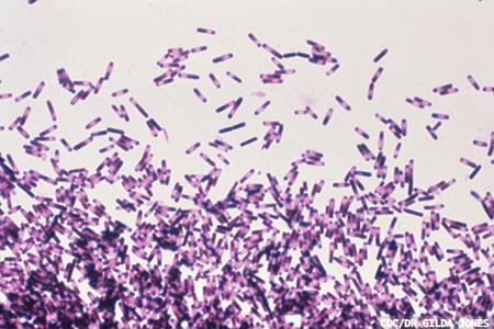 Clostridium difficile: value  of the GDH, toxin and tcdB testing algorithm