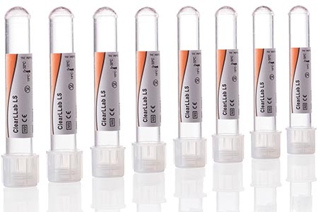 Leukaemia and lymphoma analysis by flow cytometry