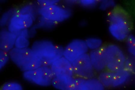 Fluorescence in situ hybridisation probes