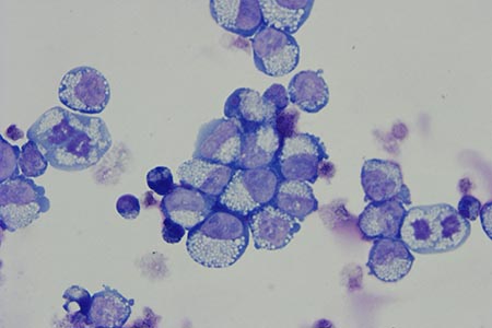 Bristol breakthrough in the manufacture of red blood cells