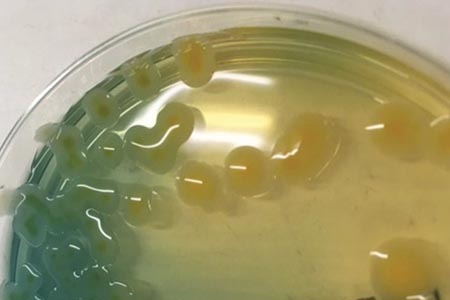 OXA-48-, KPC- & NDM-type  carbapenemase-producing organism detection 