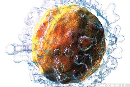Personalised cellular immunotherapies using regulatory T cells