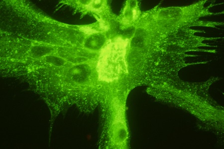 Herpes virus monoclonal antibodies