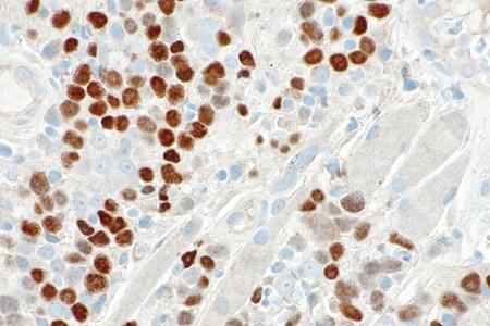 Initiative to raise awareness of HPV diseases in men welcomed