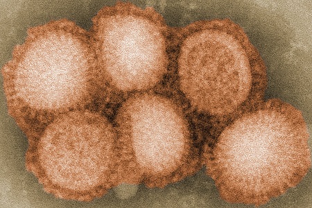 Influenza: a century on