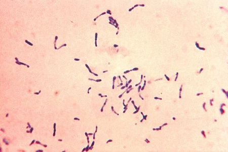 Diphtheria: forgotten but definitely not gone away