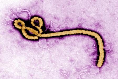 Diagnosing immunity to Ebola 