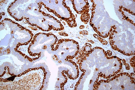 Immunohistochemistry video training series