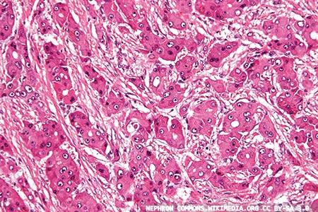 Non-invasive liver profile testing
