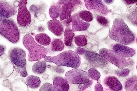 Mycoplasma genitalium Positive Control kit gains FDA clearance 