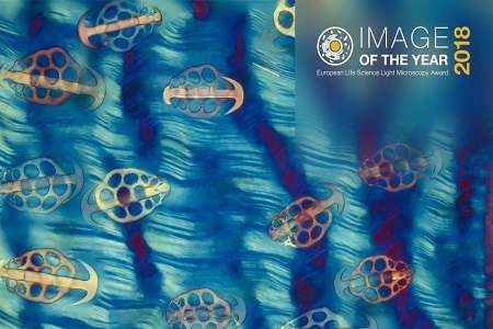Celebrate art in science with the Image of the Year Award 