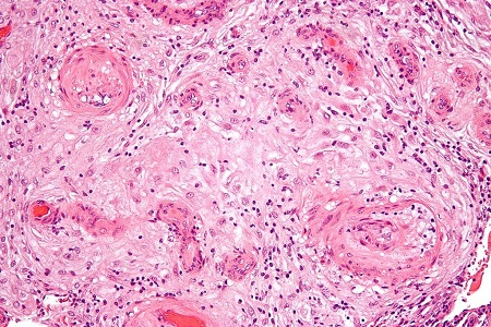 Minimising uncertainty in laboratory medicine