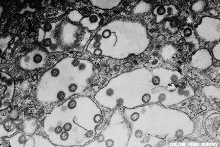 Rift Valley fever: new insight, and hope for the future