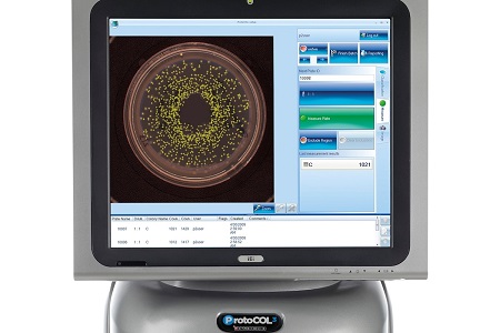 Major London hospital uses automated colony counter