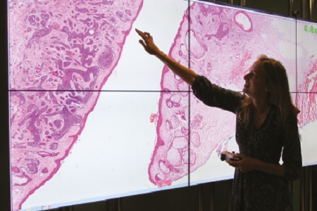 Innovation in digital pathology at Leeds a step to faster, better cancer diagnosis