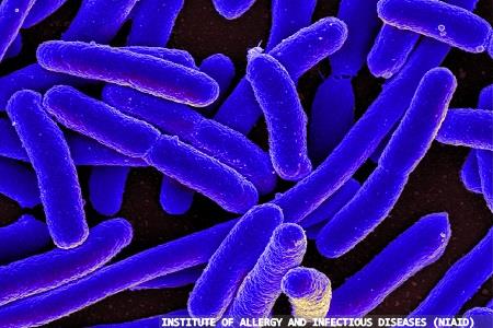 Neutrons help to analyse outer surface interactions on Gram-negative bacteria