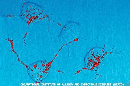 Prion diseases: a brief look  in the current literature