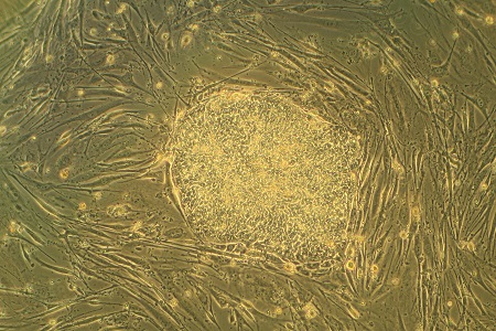 Scientists identify ‘origin’ of cancer spread