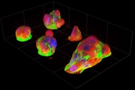 Micro-platform reveals natural behaviour of cancer cells 