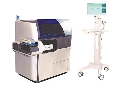 Automated algorithm for lupus anticoagulant testing aids challenging diagnoses