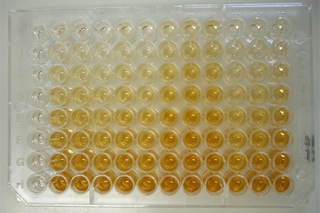 Software to reduce variability in ELISA biomarker tests