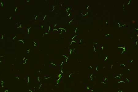 Treponema pallidum monoclonal antibodies
